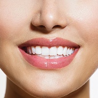 A patient who’s received teeth whitening in Covington.