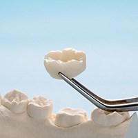 Dental forceps holding crown in front of plaster tooth model