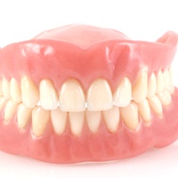 A complete denture.
