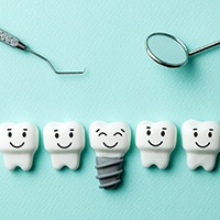 Illustration of dental implant in Covington