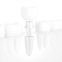 Animated implant supported dental crown placement