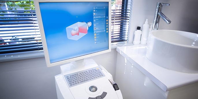 3D images of tooth design on computer screen
