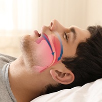 Sleeping man with airway animation over profile