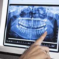 Panoramic dental x-rays on computer screen