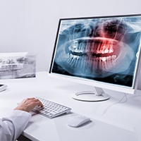 Panoramic dental x-rays