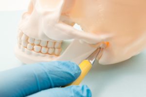 dentist pointing to the temporomandibular joint on a skull