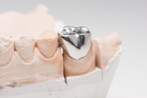 Metal dental crown.